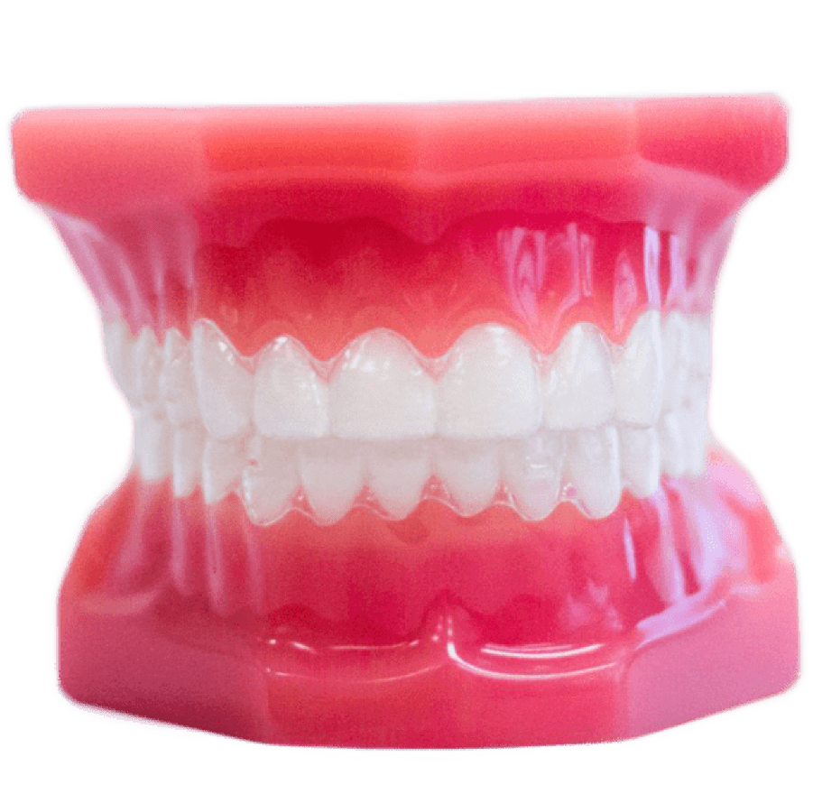 invisalign clear aligners on plastic model