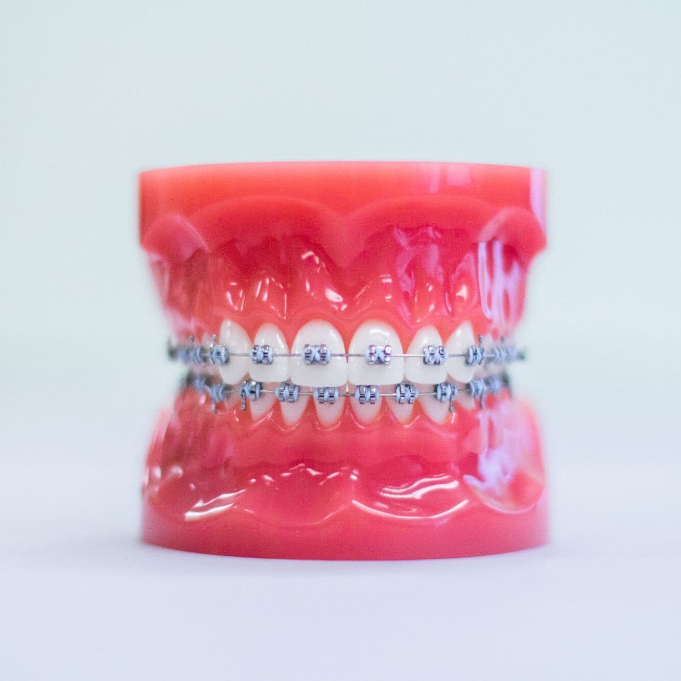 metal braces peach tree city