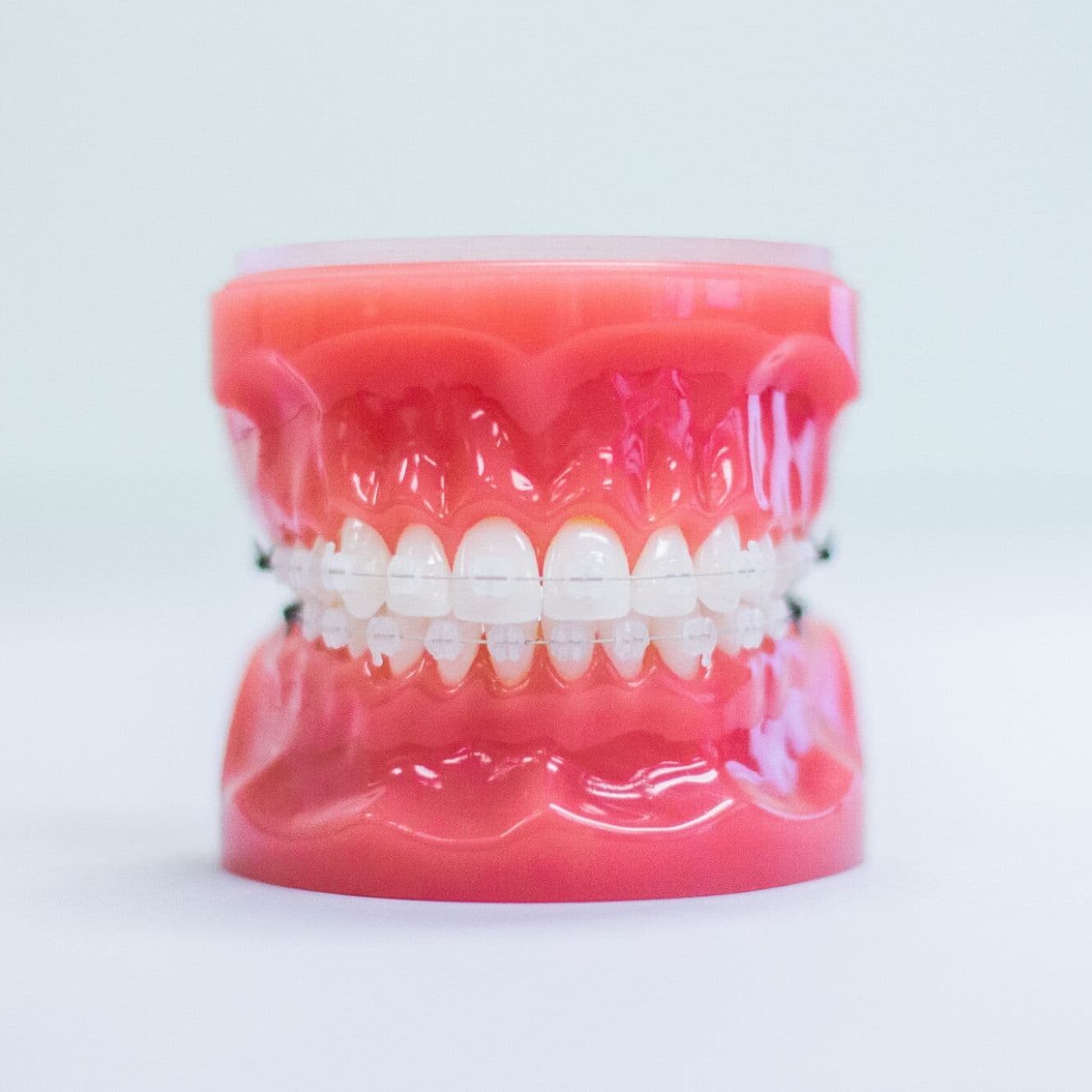 clear braces peach tree city